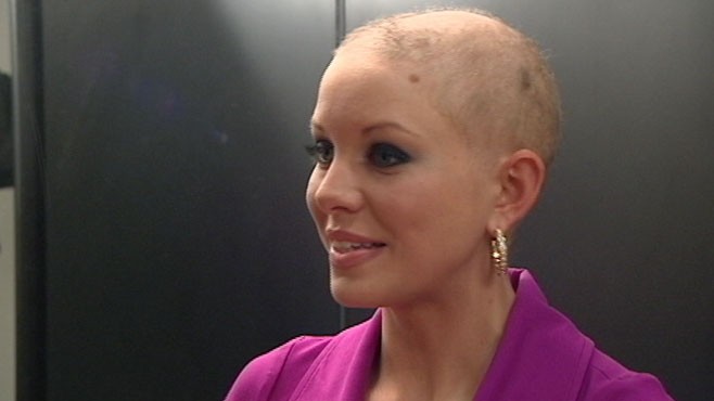 VIDEO: Kayla Martell copes with hair loss; quot;I was given this for a 