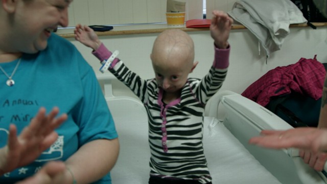 VIDEO: Thanks to a new drug treatment, Lindsay Ratcliffe grew 6 cm and added 2.2 lbs.; watch Sat. 8 p.m.