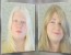 VIDEO: Teen with Albinism Gets Makeover 