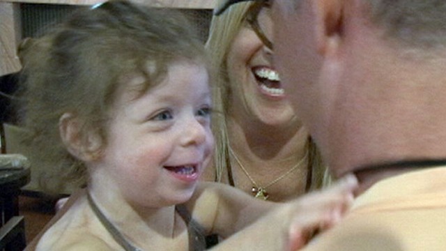 VIDEO: Williams Syndrome kids have health problems but also lack social inhibition.