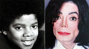 Why Did King of Pop Go so Far to Alter His Appearance?