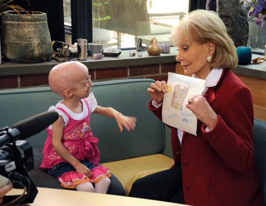 Barbara Walters Progeria