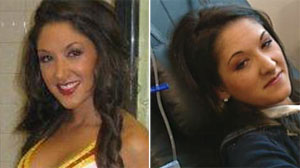 Medical Mystery or Hoax: Did Cheerleader Fake a Muscle Disorder?