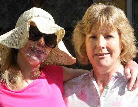 Photo: British model Katie Piper was brutally burned when a stranger threw sulfuric acid in her face.