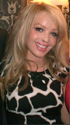 Photo: British model Katie Piper was brutally burned when a stranger threw sulfuric acid in her face.