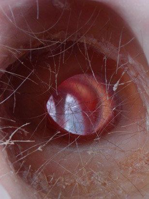 Inside the Living Body