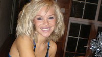 Photo: Model Burned in Vicious Sulfuric Acid Attack: Katie Piper's Dreams Destroyed: 'The Pain Was So Bad I Thought This Guy's Thrown a Match at Me'