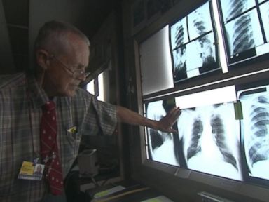 New Hope for Coal Miners Seeking Black Lung Benefits