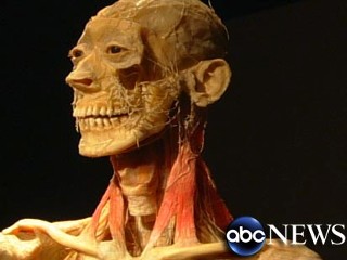 Bodies Exhibit