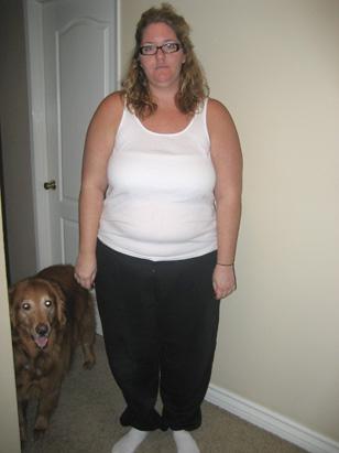 Thousands of people signed up, including Cassie Gibbons, seen here before surgery, who lost more than 100 pounds and was later featured in 1-800-Get-Thin ads. 