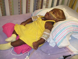 Tragic Medication Errors Result in Accidental Abortions and Premature Birth