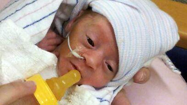 PHOTO: C-section baby