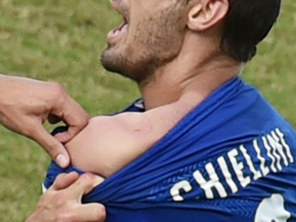 gty_giorgio_chiellini_bite_FIFA_2014_soccer_jc_140624_4x3_992.jpg