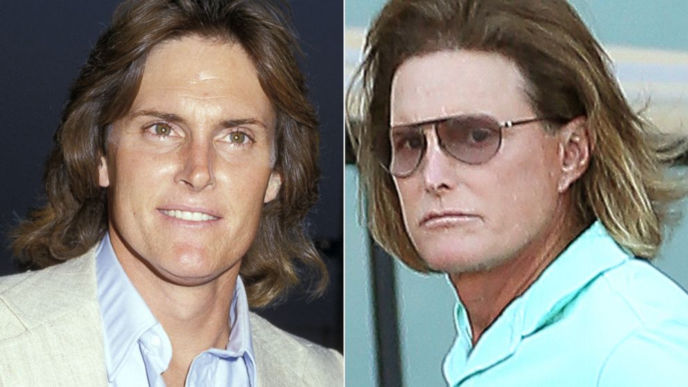 Details of Bruce Jenner's Evolving Look ABC News