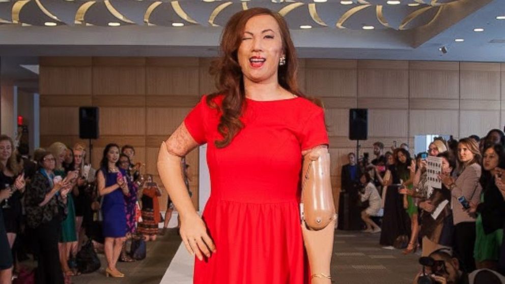 Moda Karen Crespo: Modella sfila con protesi al New York Fashion Week