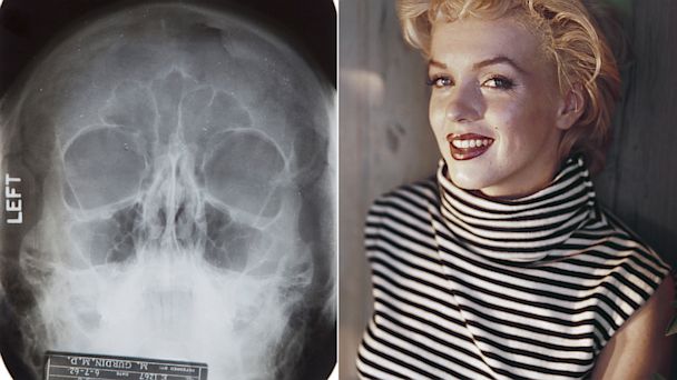 Notes Suggesting Marilyn Monroe Plastic Surgery for Sale - ABC News