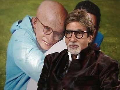 VIDEO: 68-year-old actor Amitabh Bachchan plays a boy with Progeria in the movie Paa.