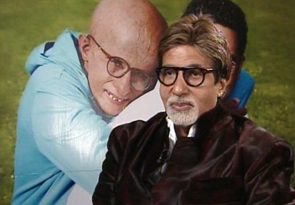 VIDEO: 68-year-old actor Amitabh Bachchan plays a boy with Progeria in the movie Paa.