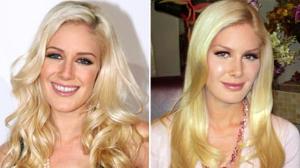 Heidi Montags 10 Plastic Surgeries