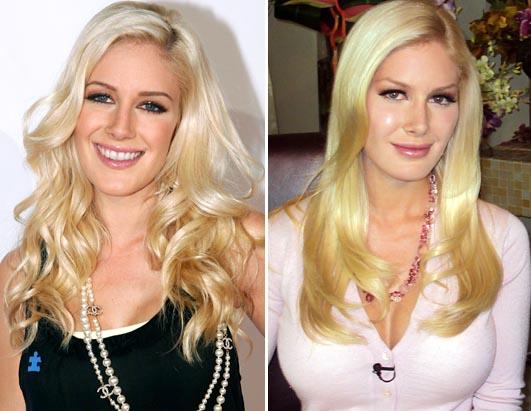 for a reality star gone wrong; Miss Heidi Montag, cast member of MTV's The 