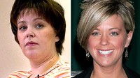 Kate Gosselin before and after