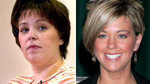 Kate Gosselin before and after
