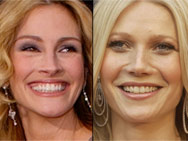 hollywood smiles