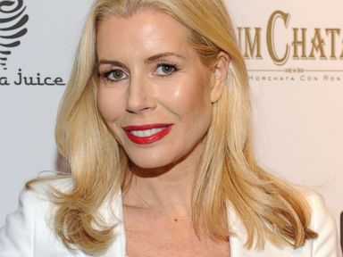 'Real Housewife' Explains Throwing Prosthetic Leg at Party