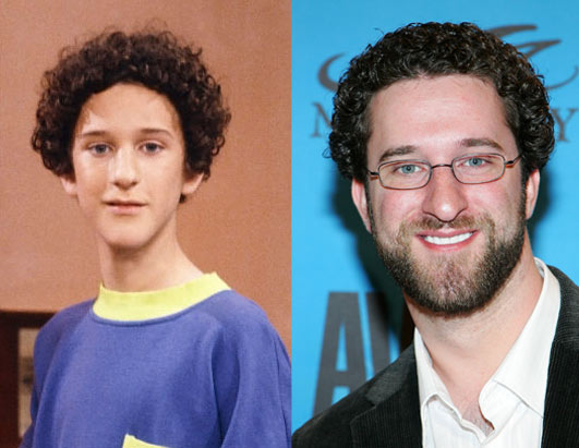Why do all Hasidic Jews look like Screech from Saved By The Bell?