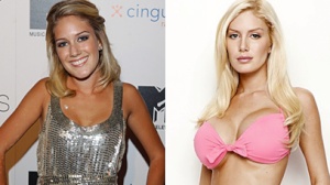 Heidi Montags Plastic Surgery Transformation