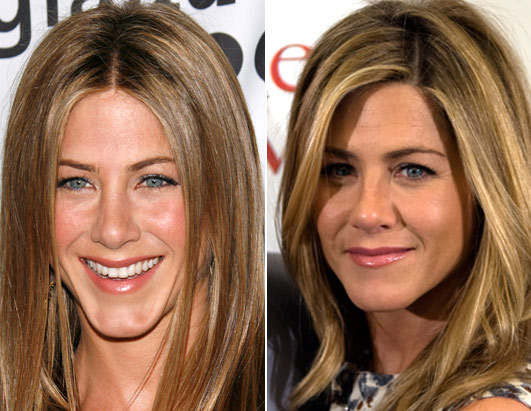 jennifer aniston surgery before after. jennifer aniston plastic