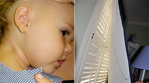 Robert and Susan Ursprung?s son was injured when he became tangled in the blinds.