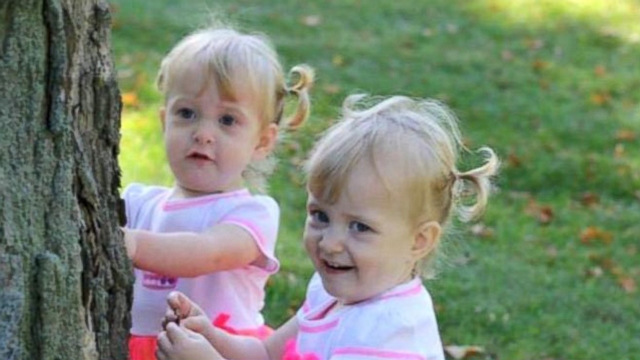VIDEO: The improbable story of Allison and Amelia Tucker.