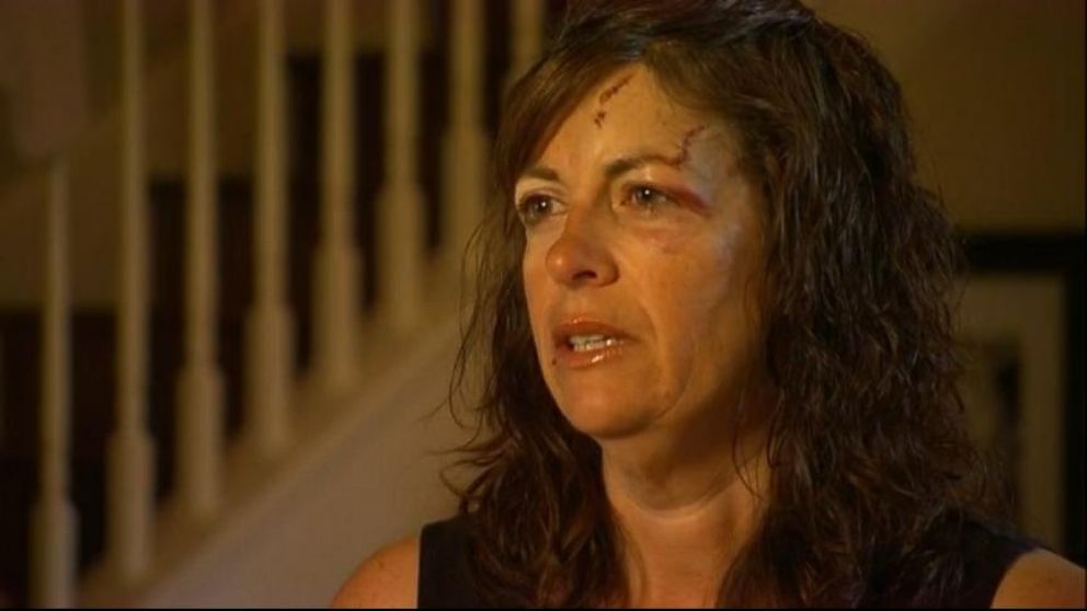 VIDEO: Bear Attack Victim Left Horrifying iPhone Message for Husband