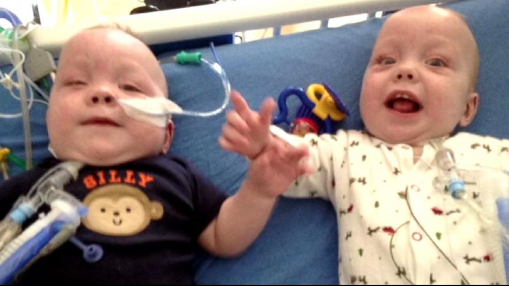 VIDEO: Owen and Emmett Ezell, who once shared a liver and intestines, are on the road to recovery.