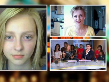 Woman Takes 6 Years of Selfies to Overcome Struggle With Hair-Pulling Disorder