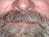 Beards
