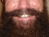 Beards