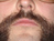 Beards