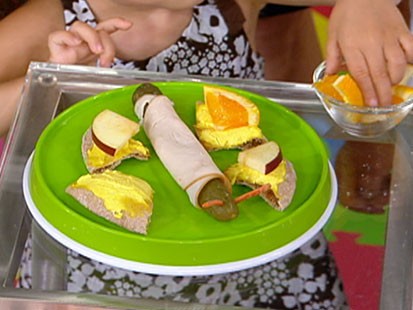 Shannon Payette Seip's bug bites are shown.