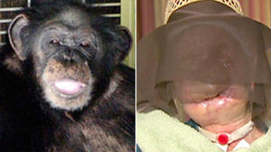 woman attacked by chimpanzee