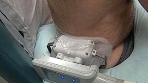 Patients Flock to Fat-Freezing Procedure, Sans FDA Approval