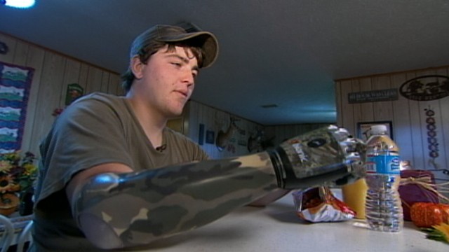 VIDEO: Fred Langdale made a split-second decision to sacrifice his right arm to save his life.