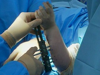 arm surgery