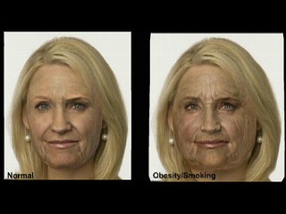 before and after