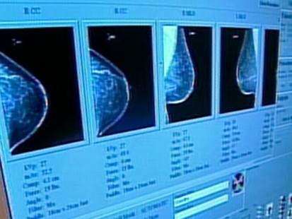 VIDEO: Dr. Richard Besser explains conflicting studies on mammograms.