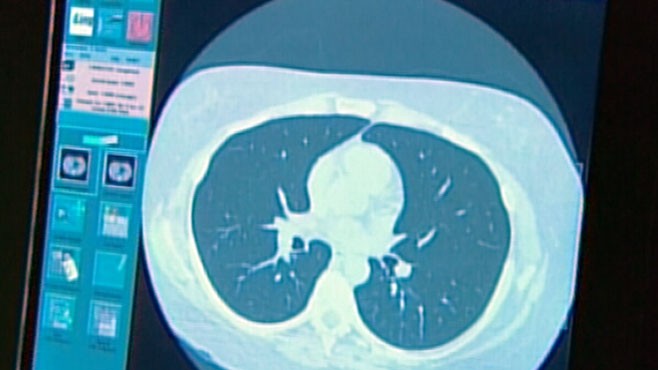 VIDEO: Dr. Richard Besser on a potential life-saving test for the deadliest of cancers.