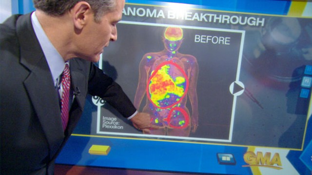 VIDEO: Dr. Richard Besser explains why recent medical breakthroughs are important.