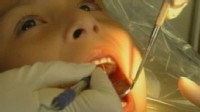 VIDEO:  Dr. Richard Besser discusses study and explains if patients should avoid X-rays.