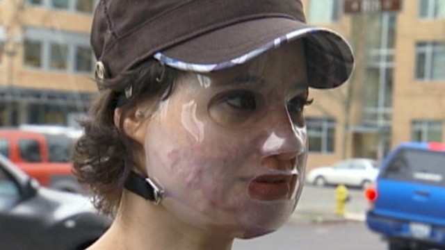 VIDEO: Acid Attack Hoax Admits Lying